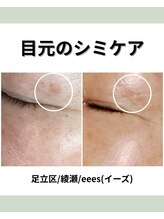 イーズ(eees)/目元のシミケア