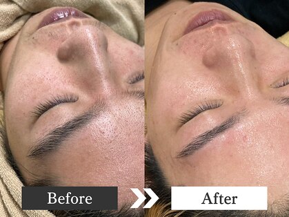 メンズオージー 岡山中区(men's O.G)の写真