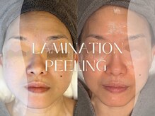 キュレイテッドスキン(CURATED SKIN)/最強艶肌【低刺激ピーリング】