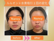ヨサパーク ナンシー(YOSA PARK Nancy)