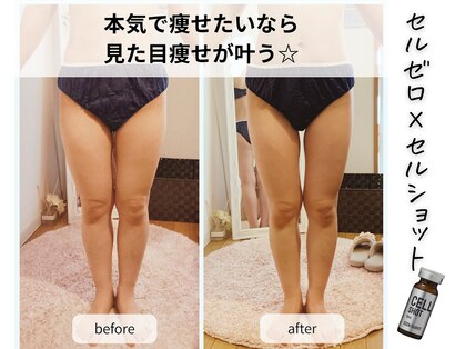 リアン(Rian)の写真