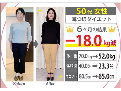 ミラクル ビー(ミラクル Bee)の写真