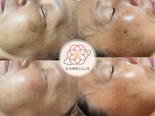 リラクビューティー カメリア(Camellia)