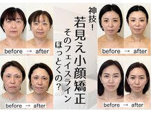 幸せ甦顔