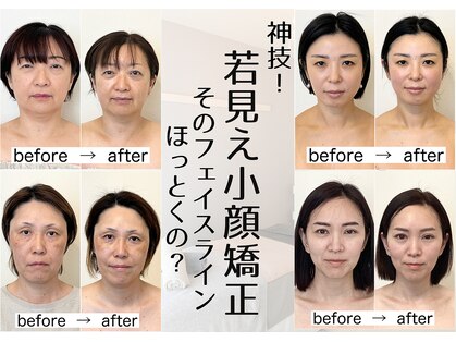 幸せ甦顔の写真