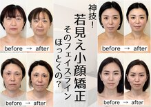 幸せ甦顔