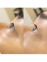 ルーム バイ アルジーヌ(Room by Argine)/ラッシュリフト★メンズ