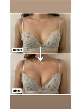 プレフィール(PLEAFEEL)/