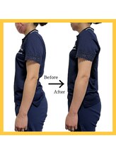 美容整体 レモン/巻き肩改善