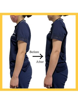 美容整体 レモン/巻き肩改善