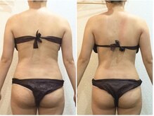 美容整体ウェリナ あま甚目寺院/小顔矯正/骨盤矯正/美脚サロン