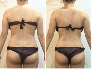 美容整体ウェリナ あま甚目寺院/小顔矯正/骨盤矯正/美脚サロン