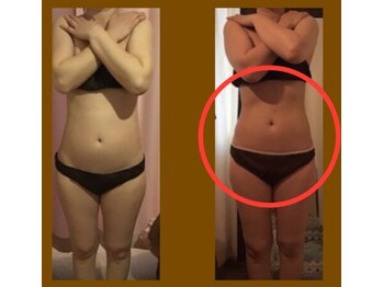 サロンドボーテ ヴィクトワール マルヤマ(Salon de beaute VICTOIRE MARUYAMA)/結果にこだわるサロン