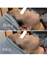 オルオル 天神大名店(Olu-.olu.)/肌質改善しみ改善/小顔/ツヤ肌