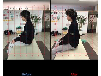 ストレチックス 近江八幡店/BeforeAfter