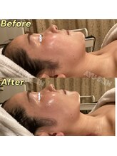 アユスリム(AYU SLIM)/一回でも変化できるの充実小顔