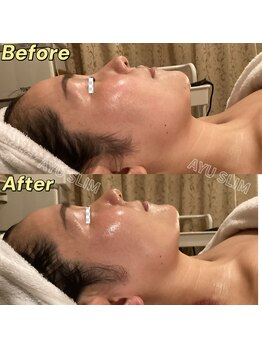 アユスリム(AYU SLIM)/一回でも変化できるの充実小顔