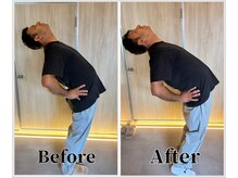 整体ラルース 中目黒(LALUZ)/40代　男性　猫背、腰痛改善