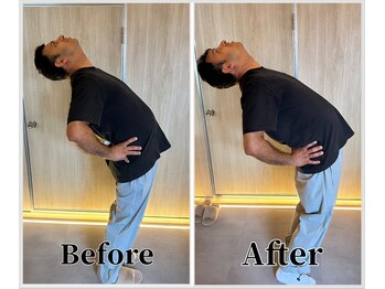 整体ラルース 中目黒(LALUZ)/40代 男性 猫背、腰痛改善