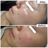 エミレーブ シロカネ(Hemireve Shirokane)