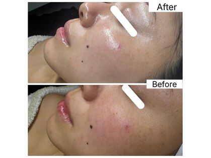 エミレーブ シロカネ(Hemireve Shirokane)の写真