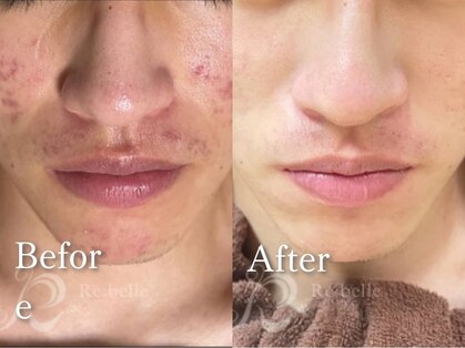 リン 長崎 大村(Rin)の写真