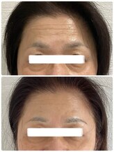 ビープラスサロン(Be plus salon)/