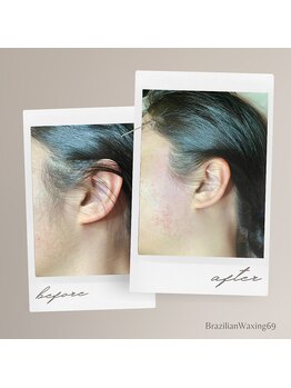 ブラジリアンワキシング シックスナイン(BrazilianWaxing69)/女性 / もみあげ