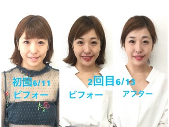 ビューティスタジオＫ/小顔矯正ビフォーアフター