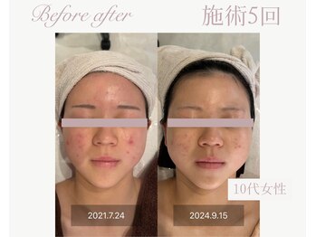 パルタージュ(Partage)/