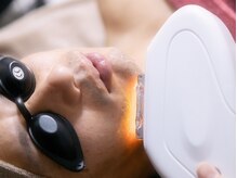 ルボーテ(Re beaute)/メンズ脱毛