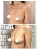 【卒乳後1年以内！産後ママ限定！】産後バストスピード復活コース！