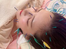 瑞 鍼灸院