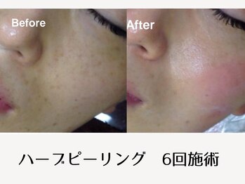 フアリト 江坂店(Fuari-to)/Before After1