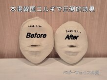 薬手名家 心斎橋店/お客様ビフォアフター