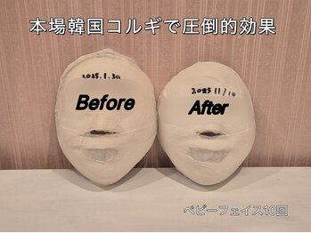 薬手名家 心斎橋店/お客様ビフォアフター