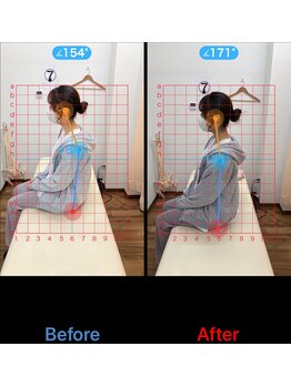 金町駅前整体院/ビフォーアフター