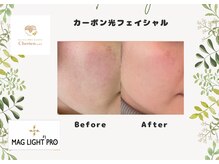 シェリアン バイ アイビー(Cherien by IVY)/悩んでいるしみ、毛穴をキレイに