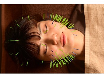 シン(SHINE)/美容鍼