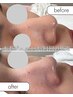 【平日限定】クイック水光肌★毛穴洗浄×トリートメントパック（45分）