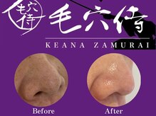 マイ フェア レディ(MY FAIR LADY)/毛穴侍