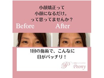 ピオニー(Peony)/Before & After