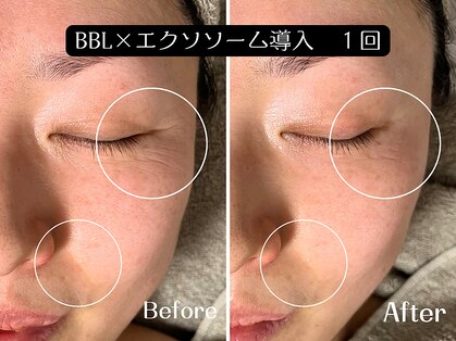 シェリ フルール(Cheri Fleur)の写真