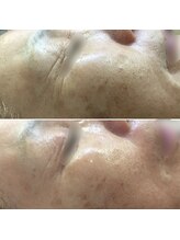 ドルフィン(Dolphin)/★お客様ビフォーアフター