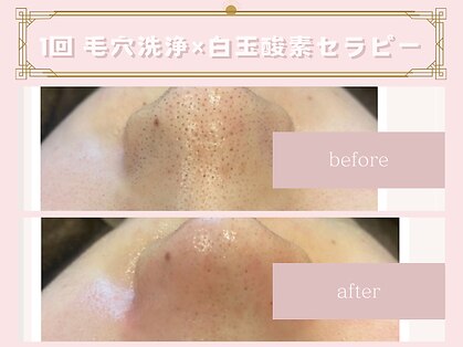 ハンティス(HANTHIS)の写真