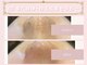 ハンティス(HANTHIS)の写真