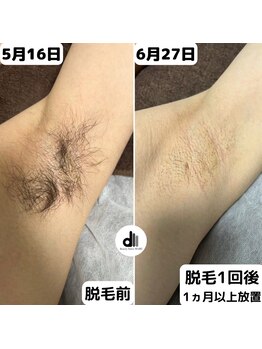 ビューティーサロン マル(Beauty Salon MARU)/