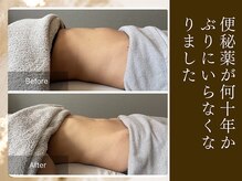 エミフル(emifull)/長年の悩みが腸もみでなくなった