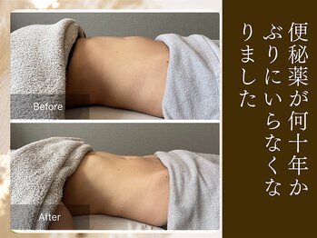 エミフル(emifull)/長年の悩みが腸もみでなくなった