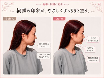リストアハート(Restore Heart)の写真